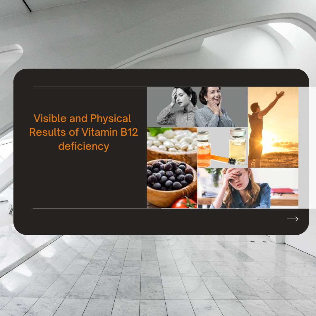 Vitamin B12 Deficient patient Vitamin B12 Deficient patient